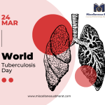 Tuberculosis